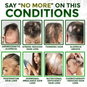 👱‍♂️ Blizkox® Microneedle Herbal Infusion Hair Stimulation Set 🇺🇸 Made in USA