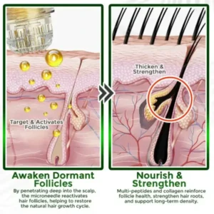 👱‍♂️ Blizkox® Microneedle Herbal Infusion Hair Stimulation Set 🇺🇸 Made in USA