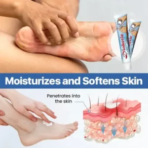 Blizkox® VitaGluco Diabetes Treatment Cream