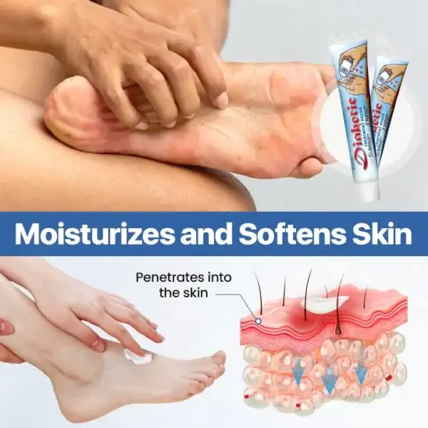 Blizkox® VitaGluco Diabetes Treatment Cream